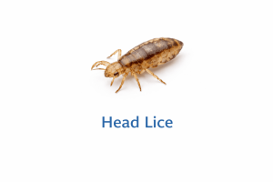 Head Lice Image 300x